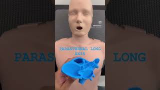 Parasternal long axis view orientation  POCUS  Dr Koratala shorts [upl. by Slayton]