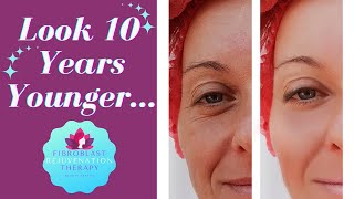 Look 10 Years Younger  About Fibroblast Rejuvenation Skin Tightening Treatments [upl. by Granthem]