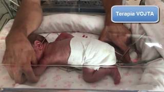 FISIOTERAPIA EN NEONATOLOGÍA [upl. by Chesna151]