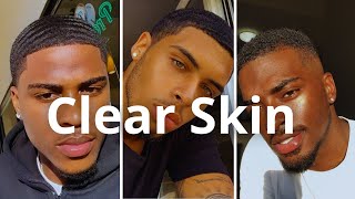 How To Get Clear Skin Naturally [upl. by Lemaceon]