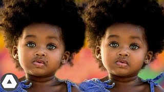 10 Rarest Black Twins Who Are One In a Million [upl. by Keane]