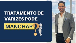 Tratamento de varizes pode causar manchas O que fazer para prevenir [upl. by Yenaiv]