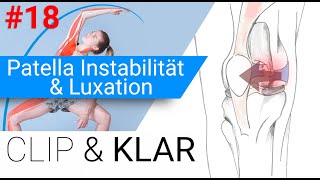 Patella Instabilität amp Luxation erklärt  Kniescheibe auf Abwegen [upl. by Joashus]