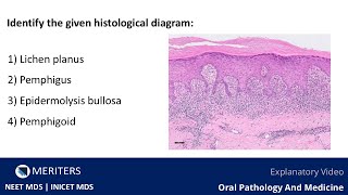 NEET MDS  INICET  OPM  Skin And Vesiculobullous Lesions  Explanatory Video  MERITERS [upl. by Atterys846]