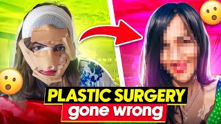 I got Plastic Surgery and Now I REGRET it 😱 YE KYA KAR LIYA [upl. by Adara]