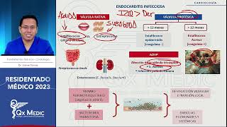 12 Endocarditis infecciosa [upl. by Evets924]