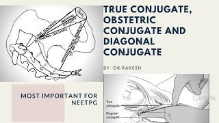 True conjugatediagonal conjugatemeasured clinically obstetric conjugate most imp for neetpg [upl. by Atinel712]