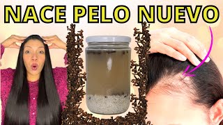 EL CABELLO CRECE COMO LOCO Y NO SE CAE😱 LA MEJOR RECETA DEL MUNDO PARA CRECER PELO😍FORMULA POTENTE [upl. by Grevera521]