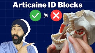 Articaine ID Blocks and the Crestal Intraosseous Approach for Local Anaesthetic  PDP143 [upl. by Ailat728]