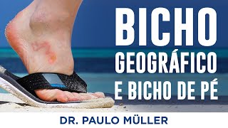 Bicho Geográfico e Bicho de Pé  Dr Paulo Müller Dermatologista [upl. by Swirsky467]