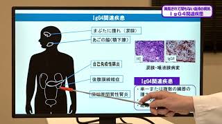 20240420 『IgG4関連疾患』 血液・リウマチ膠原病科：川野 充弘 教授 [upl. by Nnayrb]