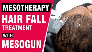 Mesotherapy Hair Fall Treatment With Mesogun  Procedure Video  Sakhiya Skin Clinic [upl. by Telford]