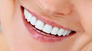 🔴 5 Coisas Para Você Usar Prótese Dentária Removível [upl. by Hpejsoj]