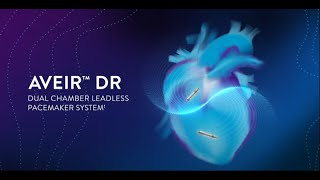 AVEIR DR™ Dual Chamber Leadless Pacemaker System 3D Implantation Simulation [upl. by Iggie]