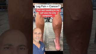 Leg Pain 1st Sign of Cancer shorts [upl. by Mcgraw]