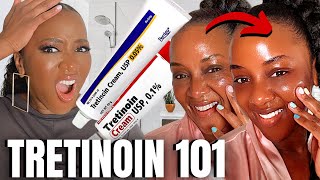 Heres how to PROPERLY Start Tretinoin [upl. by Salvatore]