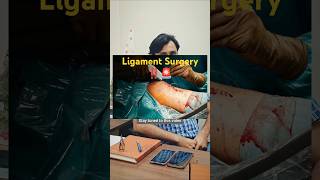 Ligament Surgery kis age group ko jyada jarurat hoti hai dailytips health doctor viralvideo [upl. by Eralc502]