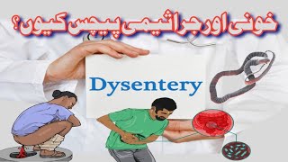 Dysentery Types I Bacillary Sign Symptoms Treatment I Faisal Shaheen [upl. by Durwood]