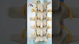 Understanding Intervertebral Discs amp Disc Herniation by Dr Abhijit Kulkarni  Brain amp Spine Surgeon [upl. by Hcirteid]