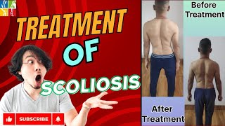 Treatment of scoliosis chiropractor chiropracticchiropractictreatment youtubeshortsytshortsyt [upl. by Assirrec10]