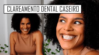 Clareamento dental caseiro  Priscila Maria [upl. by Eedebez693]