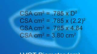 EchoWeb quotHow Toquot Series  Calculating Stroke Volume [upl. by Bigg91]