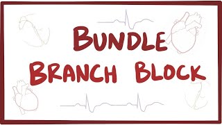 Bundle branch block  causes symptoms diagnosis treatment pathology [upl. by Yttocs185]