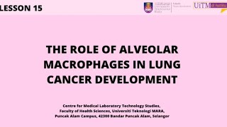 Alveolar Macrophages Role in Lung Cancer Development [upl. by Notnirb]