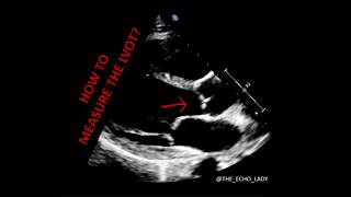 ECHOCARDIOGRAPHY How to measure the LVOT [upl. by Eniowtna]