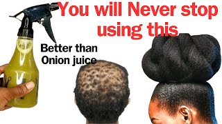 How To Use Coriander Ginger and Aloe Vera To Grow Your Hair Excessively Fast and Thick [upl. by Jammin851]