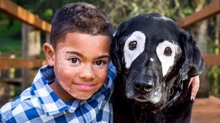 8YearOld Boy Embarrassed Of Vitiligo Meets Dog With Same Skin Condition [upl. by Euqinobe]