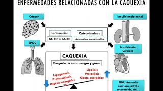 sarcopenia y caquexia [upl. by Cinom]