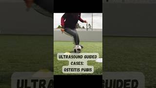 ultrasound guided interventions cases Osteitis Pubis sports sportsmedicine sportsdoctor fyp [upl. by Kielty170]