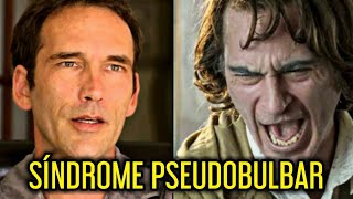 Este hombre explica como es vivir con la misma enfermedad del JOKER  Síndrome Pseudobulbar [upl. by Elo]