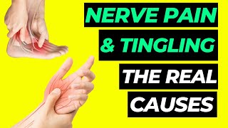 The REAL Causes Of NERVE PAIN and TINGLING In Your Feet or Hands [upl. by Gillespie]