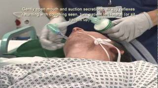 Intubation Extubation 67 [upl. by Lenroc]