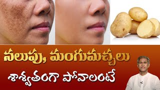 Natural Tip for Dark Spots on Face  Get Rid of Pigmentation  DrManthenas Beauty Tips [upl. by Isiad]