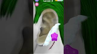 Itchy Smelly Ear Stone Removal Digging Out Super Big Earwax shorts gaming asmr [upl. by Aitsirhc]