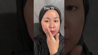 Retinol mengubah kulitmu retinol review skincare skincareroutine skincaretips [upl. by Grannias]