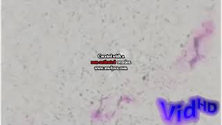 Vadimon Csupo Effects Sponsored by Preview 2 Effects [upl. by Rainger261]