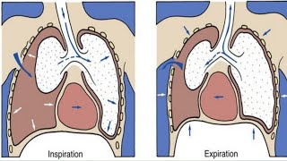 Pneumothorax amp hydropneumothorax  Chest Disease [upl. by Daeriam]