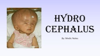 Hydrocephalus  types causes signs and symptoms investigation treatment [upl. by Gonzales]