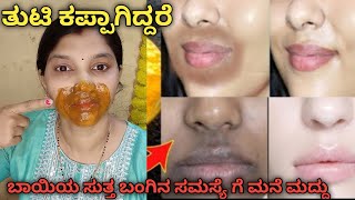 How To Remove Dark Black Patches Dark Spots Hyper Pigmentation Around Your MouthUneven Skin Tone [upl. by Hploda]