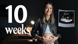 From Embryo to Fetus  The Magic of Week 10 Pregnancy [upl. by Aksehcnarf]