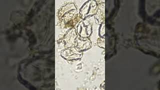 Eggs of Taenia solium Tapeworm under microscope [upl. by Anyl]