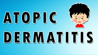 Contact dermatitis hands types causes symptoms treatment home remedy  eczema on hands [upl. by Aibara982]