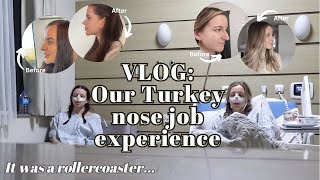 VLOG We got twin NOSE JOBS in Turkey  Surgery recovery amp cast removal [upl. by Leggat]