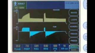 Newport e360 Ventilator Overview [upl. by Ynwat]