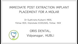 IMMEDIATE POST EXTRACTION IMPLANT PLACEMENT IN A LOWER MOLAR WITH BROKEN ROOT [upl. by Tina819]