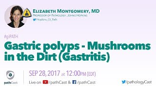 Gastric polyps  Mushrooms in the dirt GASTRITIS [upl. by Saduj]